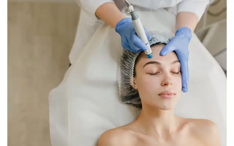 What Makes Melasma Laser Treatment A Preferred Solution For Uneven Facial Skin Tone?